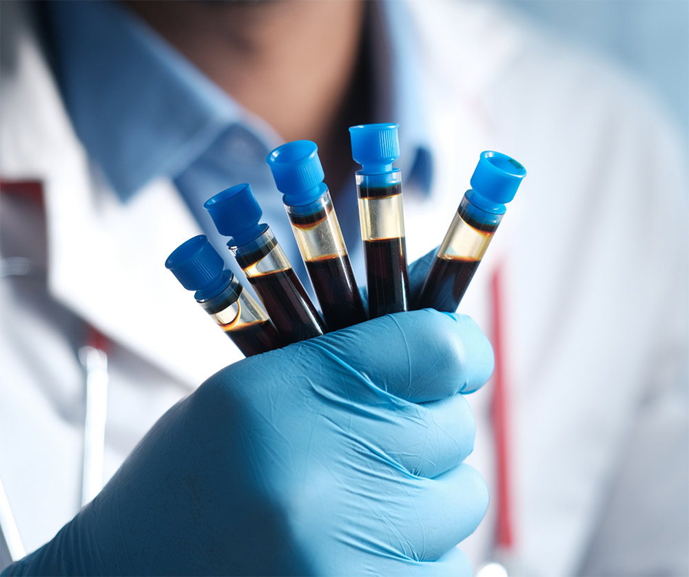 Egészség megőrző labor csomag